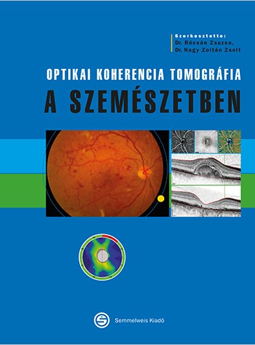 Szemészeti diagnosztikus képalkotó eljárások | Semmelweis Kiadó és Multimédia Stúdió Kft.